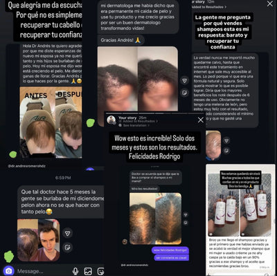 Crece Tu Cabello Naturalmente De Nuevo O Te Regresamos Tu Dinero