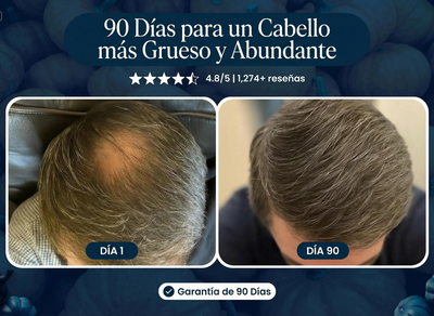Crece Tu Cabello Naturalmente De Nuevo O Te Regresamos Tu Dinero