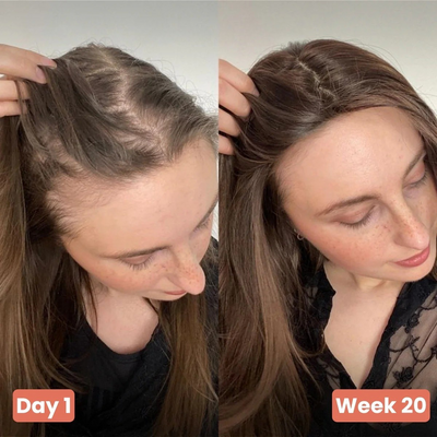 Aceite De Semilla De Calabaza - Recupera tu cabello en 120 días