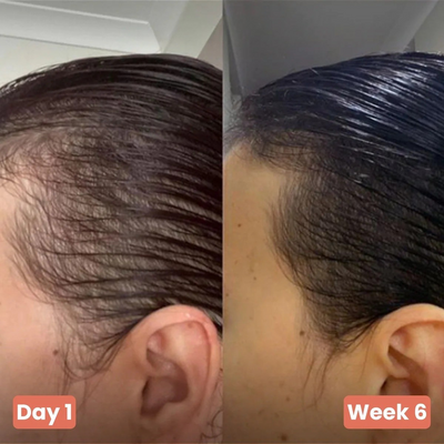 Aceite De Semilla De Calabaza - Recupera tu cabello en 120 días