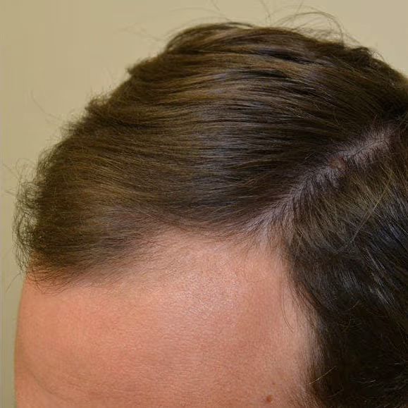 Carlos R. (32 años)