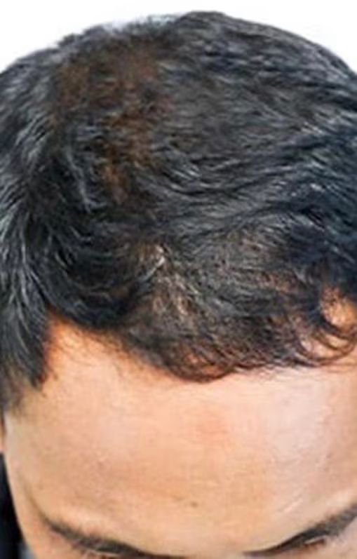 Miguel G. (28 años)